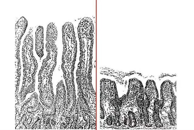 �����ĳ���ëvs���˵ĳ���ë